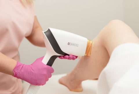 How Long Does Laser Hair Removal Last?