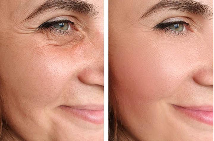 Microcurrent facial benefits