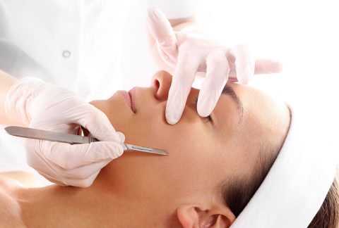 Microneedling