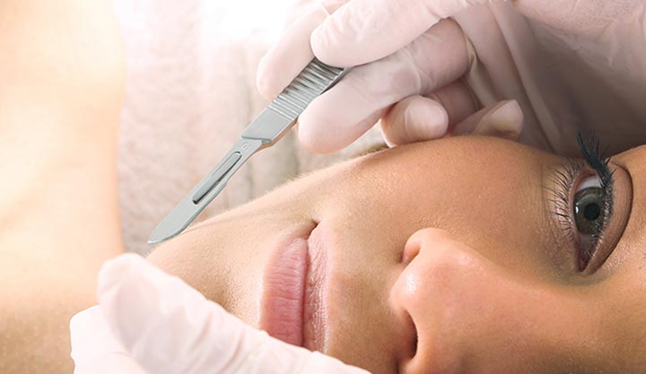 Dermaplaning pros and cons